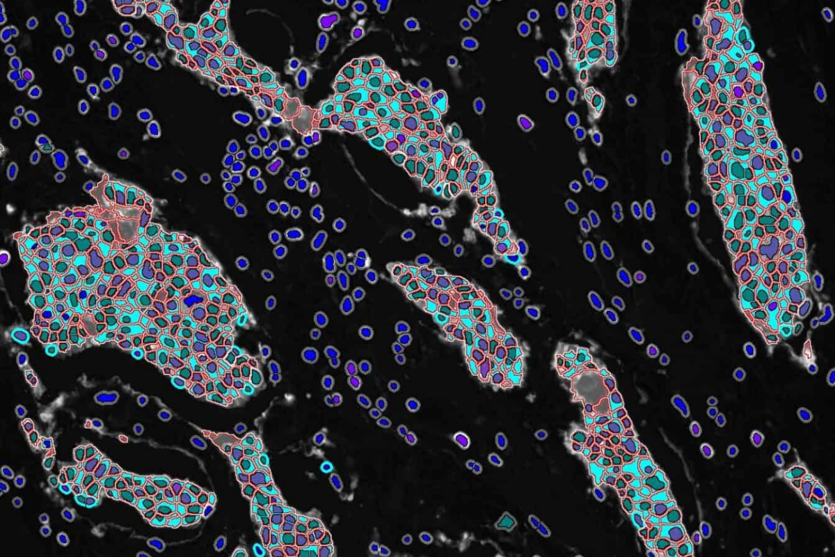 Highplex Immunofluorescence Phenotypic Characterization From Single Tissue Image