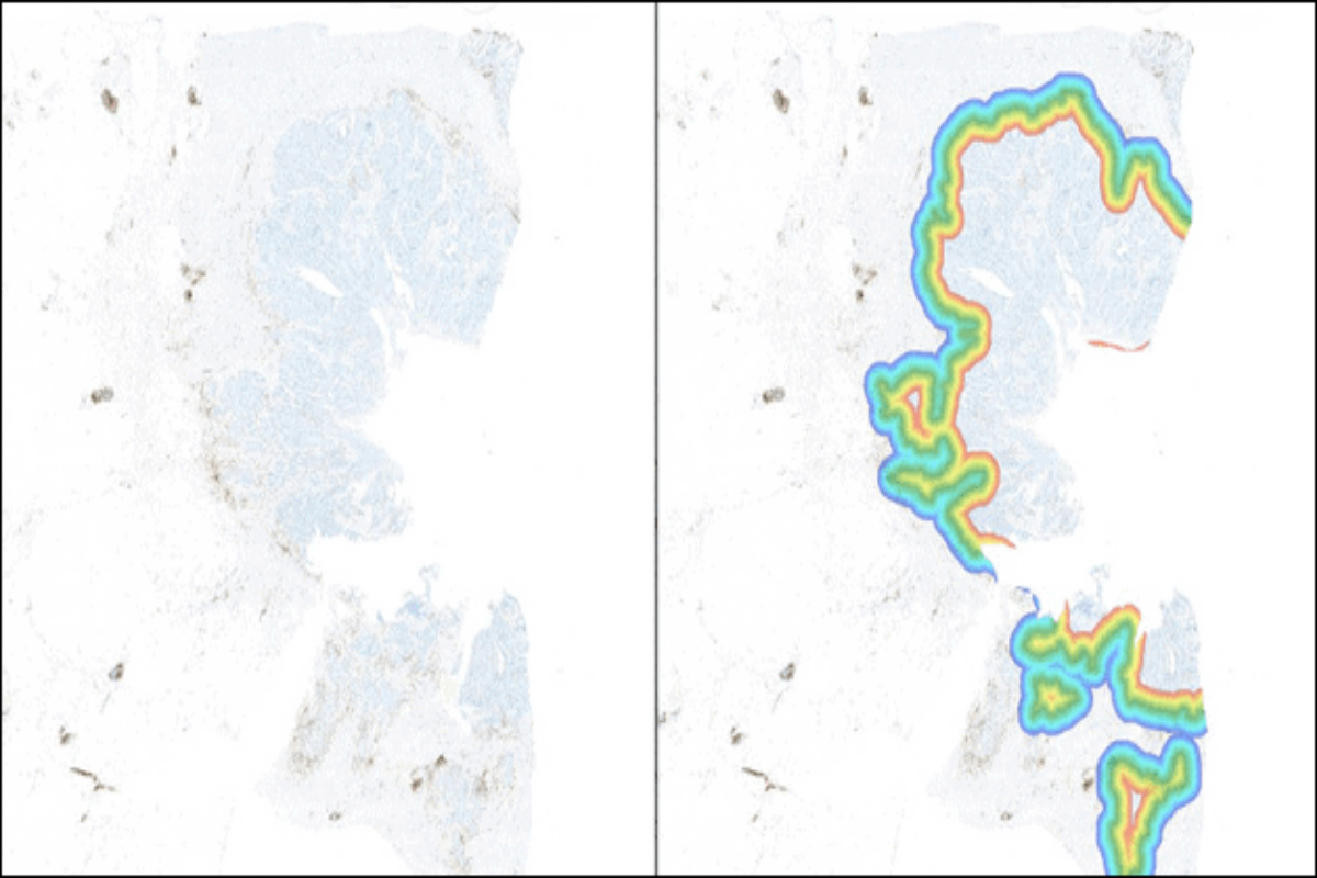 Immune Cell Infiltration Analysis