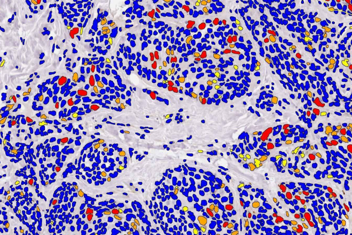 Intensity Markup for Single IHC