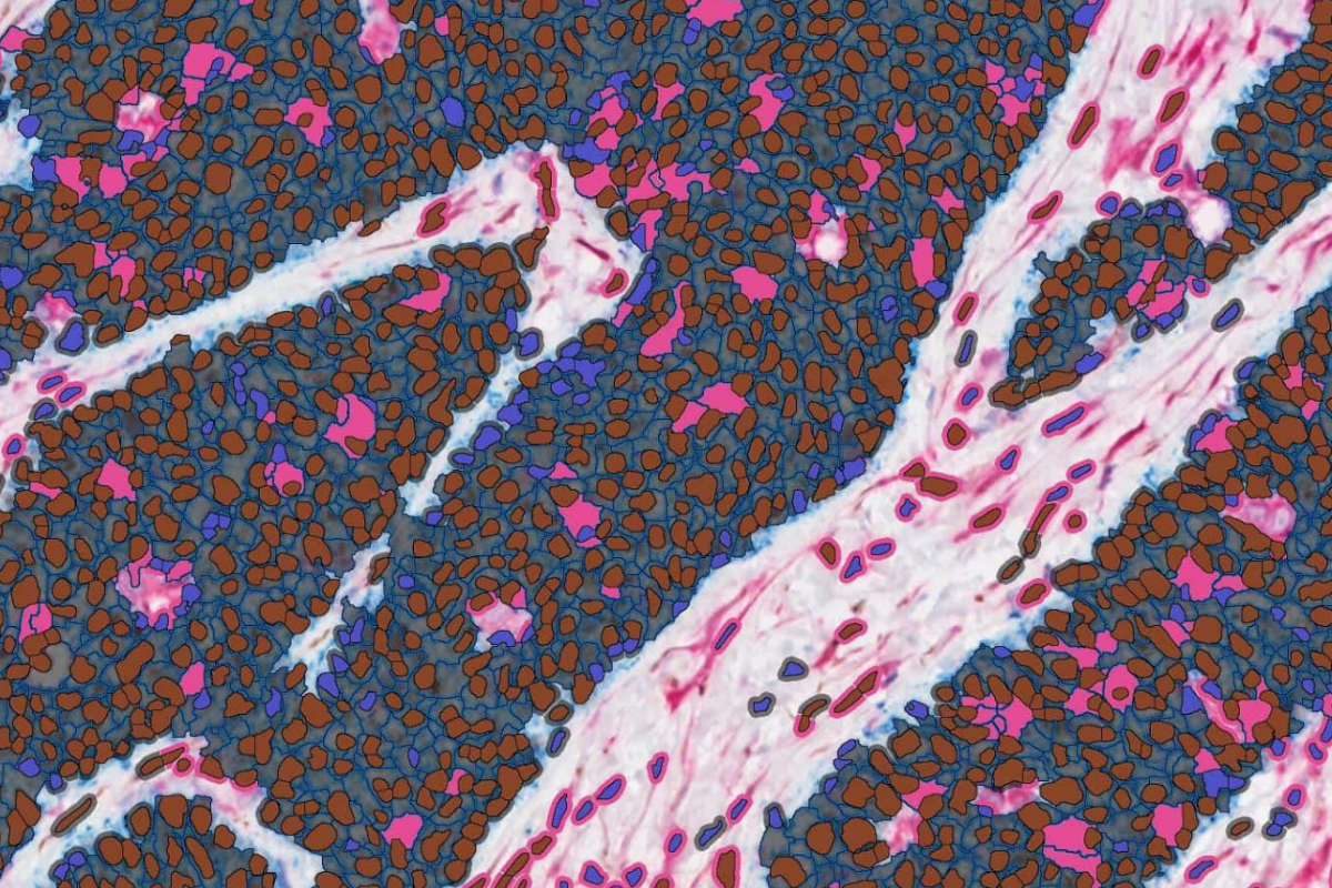 Cellular Compartment Classification