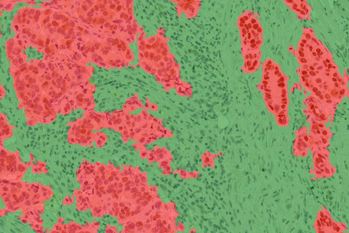 Tissue Type Classifier